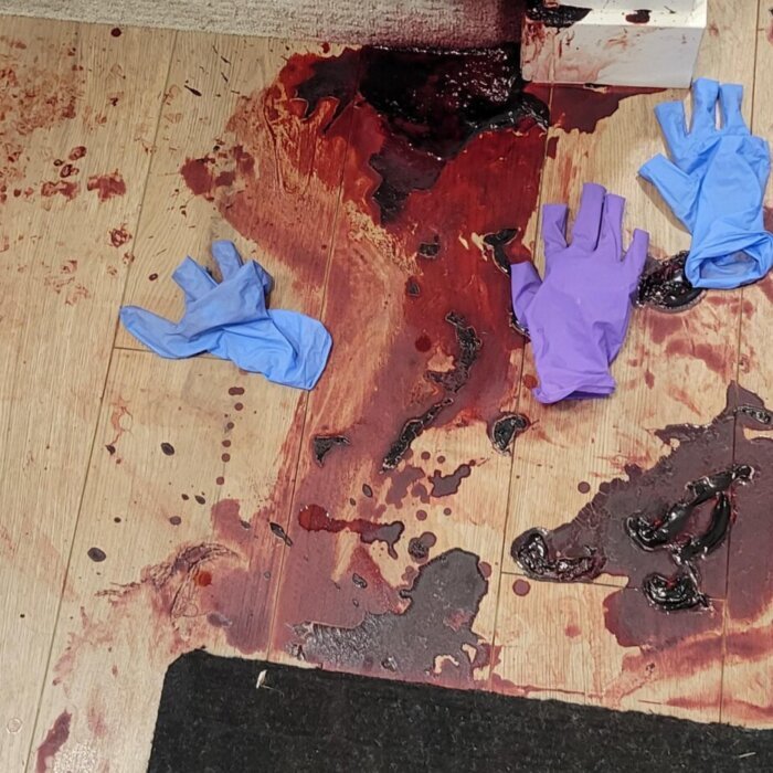 bloodborne pathogens that can happen in biohazards